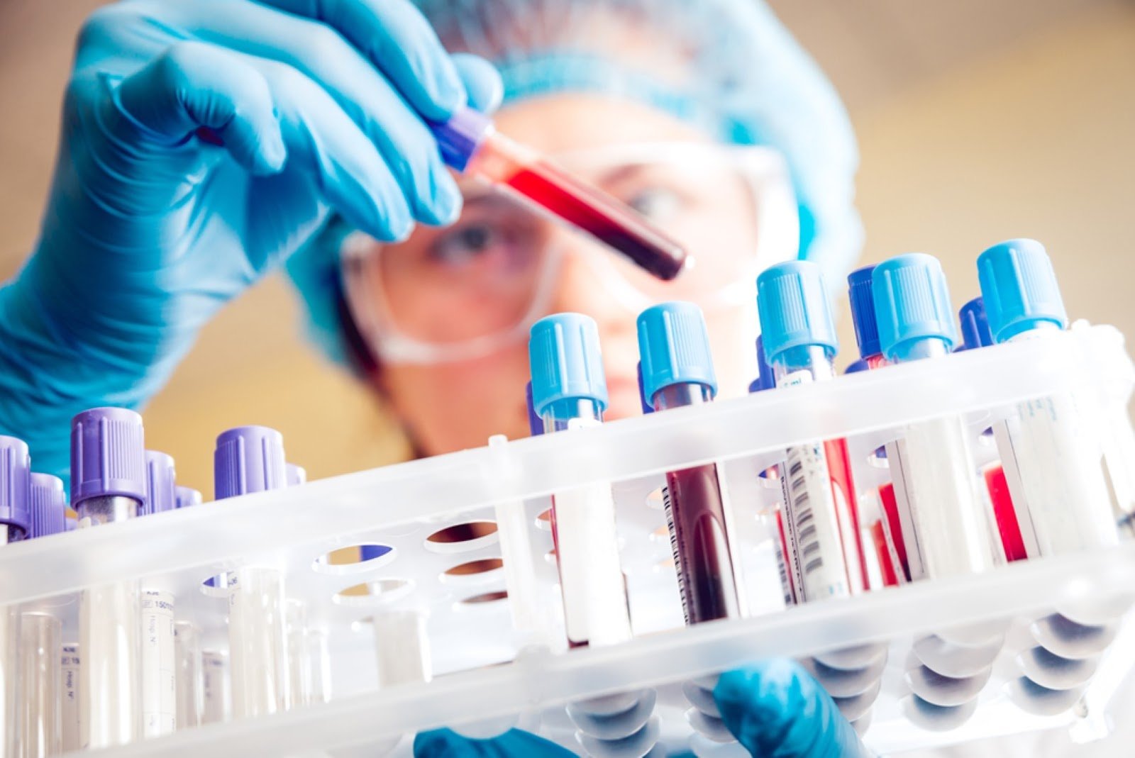 Lab technician handling a diagnostic sample vial